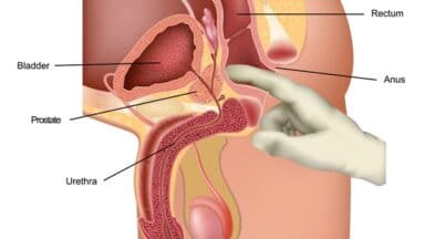 Massaggio Prostatico (Milking): i Segreti dell’Orgasmo Anale Maschile