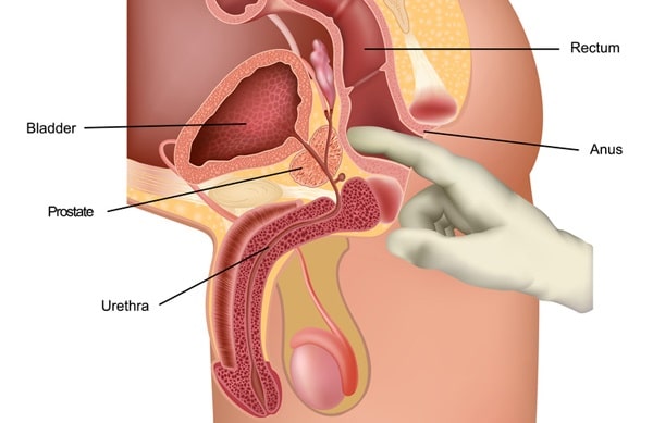 prostata sesso anale