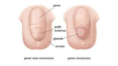 Circoncisione